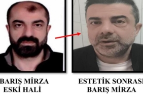yuzunu-degistiren-firari-zanli-7-yil-sonra-yakalandi-dPczv2vK.jpg