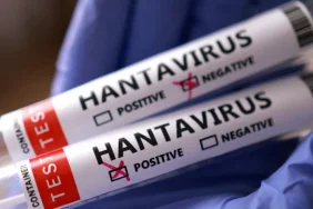 dsoden-rahatlatan-aciklama-hantavirus-enfekte-olan-kisi-icin-tehlikeli-genel-nufus-icin-risk-kesinlikle-r2nSZWPf.webp