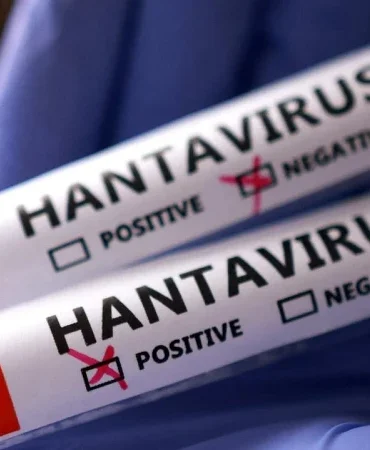 dsoden-rahatlatan-aciklama-hantavirus-enfekte-olan-kisi-icin-tehlikeli-genel-nufus-icin-risk-kesinlikle-r2nSZWPf.webp