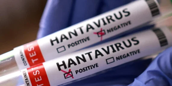 dsoden-rahatlatan-aciklama-hantavirus-enfekte-olan-kisi-icin-tehlikeli-genel-nufus-icin-risk-kesinlikle-r2nSZWPf.webp