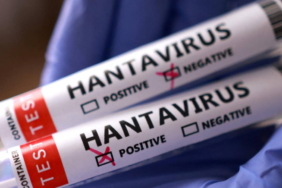 dunya-saglik-orgutu-baskanindan-hantavirus-mesaji-bu-yeni-bir-covid-19-degil-8w63LrRx.jpg