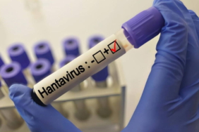 grip-ile-karistiriliyor-uzmanlardan-hantavirus-aciklamasi-evTVOVbS.jpg