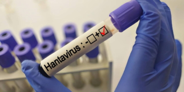 grip-ile-karistiriliyor-uzmanlardan-hantavirus-aciklamasi-evTVOVbS.jpg