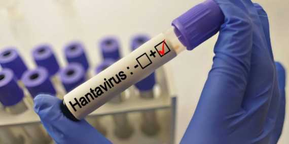 grip-ile-karistiriliyor-uzmanlardan-hantavirus-aciklamasi-evTVOVbS.jpg