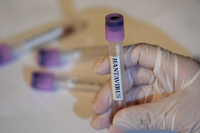 hantavirus-bir-ulkede-daha-goruldu-iqmBENRY.jpg