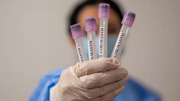 profesorden-dikkat-ceken-hantavirus-aciklamasi-yeniden-bir-pandemi-ihtimali-yok-ama-tedbir-sart-q6mTstL4.jpg