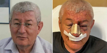 usakta-sol-parti-il-sozcusu-saldiriya-ugradi-tn4yMAai.jpg